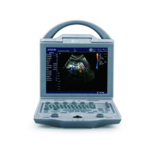 Alternative view of metal privacy screen panels